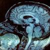 The cursor is pointing to the region of our brain devoted to music appreciation and music-making.